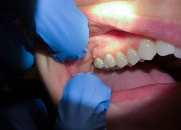 Reliable MS Emergency Dental Service Solutions