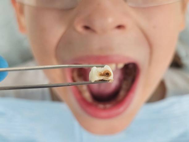Best Emergency Pediatric Dental Care in Forest, MS