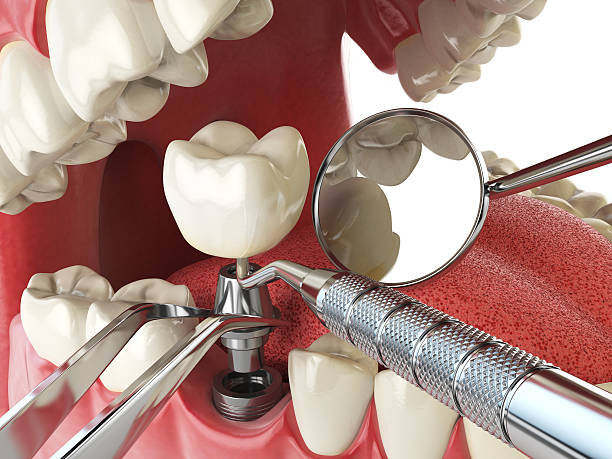 Best Emergency Treatment for Oral Infections in Forest, MS